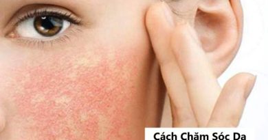 Cách Chăm Sóc Da Mặt Bị Dị Ứng