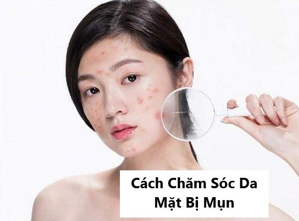 cách chăm sóc da mặt bị mụn