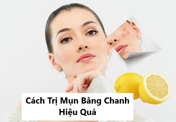 trị mụn thâm bằng chanh