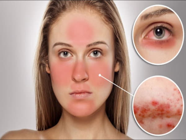 Da bị kích ứng có tự hết không?