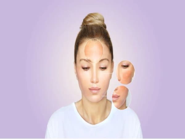 Nguyên nhân gây kích ứng da mặt